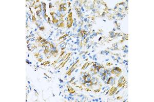 Immunohistochemistry of paraffin-embedded mouse lung using V antibody (ABIN6130774, ABIN6150046, ABIN6150047 and ABIN6224821) at dilution of 1:100 (40x lens). (VAMP1 antibody  (AA 1-96))