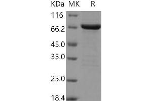 FGFR2 Protein (AA 400-821) (GST tag,His tag)