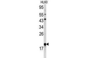 Image no. 1 for anti-Actin Related Protein 2/3 Complex, Subunit 3, 21kDa (ARPC3) (C-Term) antibody (ABIN452763) (ARPC3 antibody  (C-Term))