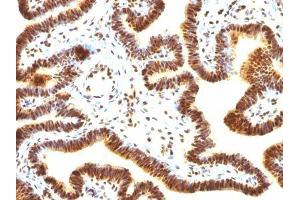 Image no. 3 for anti-Small Ubiquitin Related Modifier Protein 1 (SUMO1) antibody (ABIN6186913) (SUMO1 antibody)