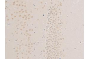 ABIN6267268 at 1/100 staining mouse brain tissue sections by IHC-P. (EGFR antibody  (pSer1026))