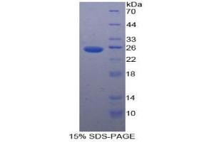 SDS-PAGE analysis of Human PK Protein.