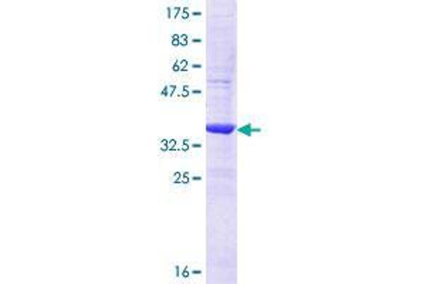 RPGRIP1 Protein (AA 1187-1286) (GST tag)