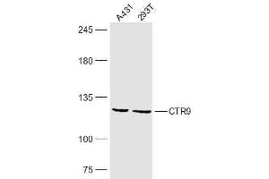 Lane 1: A431 lysates Lane 2: 293T lysates probed with CTR9 Polyclonal Antibody, Unconjugated  at 1:300 dilution and 4˚C overnight incubation. (CTR9 antibody  (AA 751-850))