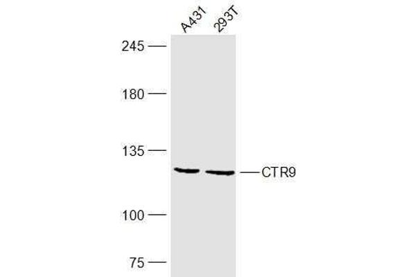 CTR9 anticorps  (AA 751-850)