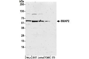 anti-Small ArfGAP2 (SMAP2) (AA 379-429) antibody
