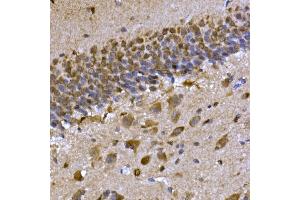 Immunohistochemistry of paraffin-embedded rat brain using CPEB3 Rabbit pAb (ABIN7266666) at dilution of 1:300 (40x lens). (CPEB3 antibody  (AA 150-400))