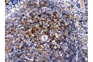 Immunohistochemistry (Paraffin-embedded Sections) (IHC (p)) image for anti-Actin, alpha 1, Skeletal Muscle (ACTA1) (AA 277-308), (C-Term) antibody (ABIN3043519) (Actin antibody  (C-Term))