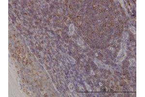 Image no. 1 for anti-ARP3 Actin-Related Protein 3 (ACTR3) (AA 1-419) antibody (ABIN599115) (ACTR3 antibody  (AA 1-419))