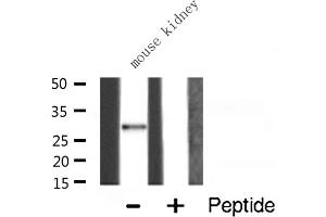 Western blot analysis of RPS4X expression in Mouse kidney lysate (RPS4X antibody  (Internal Region))