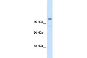 Alpha Actinin 4 antibody used at 0. (alpha Actinin 4 antibody  (C-Term))