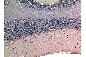 Immunohistochemistry (IHC) analysis of paraffin-embedded Rat Brain, antibody was diluted at 1:100. (Latexin antibody  (Internal Region))