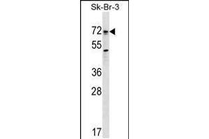 Western blot analysis in SK-BR-3 cell line lysates (35ug/lane). (BMPR1A antibody  (AA 170-197))