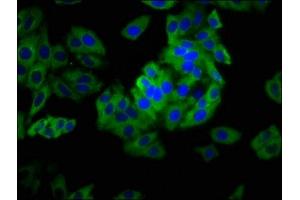 Immunofluorescence staining of HepG2 cells with ABIN7163666 at 1: 133, counter-stained with DAPI. (PHLDA1 antibody  (AA 1-138))