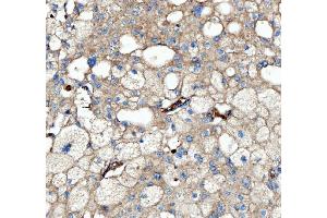 IHC analysis of Kindlin 2/FERMT2 using anti-Kindlin 2/FERMT2 antibody (ABIN7599515). (FERMT2 antibody  (AA 1-650))