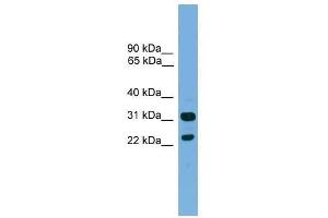 Western Blot showing CD8B antibody used at a concentration of 1-2 ug/ml to detect its target protein.