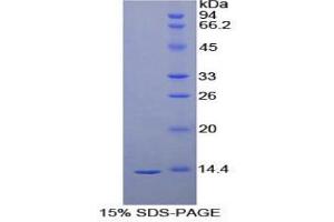 SDS-PAGE analysis of Human VEGFD Protein.