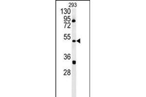 ILK Antibody (Center) 5884c western blot analysis in 293 cell line lysates (35 μg/lane). (ILKAP antibody  (AA 243-270))