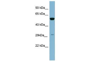 WB Suggested Anti-KLK10 Antibody Titration: 0. (Kallikrein 10 antibody  (N-Term))