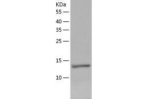 Nerve Growth Factor Protein (NGF) (AA 122-239) (His tag)