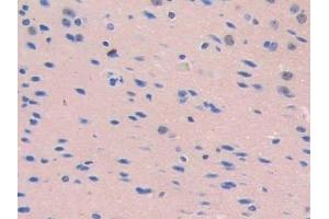 Immunohistochemistry (IHC) image for anti-CD34 (CD34) (AA 36-287) antibody (ABIN7434413)