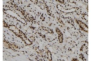 ABIN6266020 and ABIN6273186 at 1/100 staining Human kidney tissue by IHC-P. (WDR46 antibody  (Internal Region))