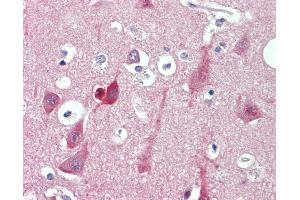 Anti-ST3GAL2 antibody IHC staining of human brain, cortex. (ST3GAL2 antibody  (C-Term))