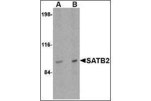 Western blot analysis of SATB2 in mouse brain tissue lysate with this product at (A) 2 and (B) 4 μg/ml. (SATB2 antibody  (N-Term))
