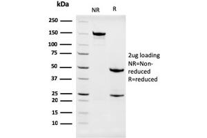SDS-PAGE (SDS) image for anti-Nucleophosmin (Nucleolar phosphoprotein B23, Numatrin) (NPM1) (AA 185-287) antibody (ABIN6940219)