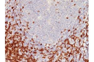 Formalin-fixed, paraffin-embedded human Tonsil stained with CD5 Mouse Monoclonal Antibody (C5/473). (CD5 antibody)