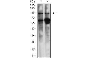 Western Blotting (WB) image for anti-Caldesmon 1 (CALD1) (AA 26-207) antibody (ABIN7193477)