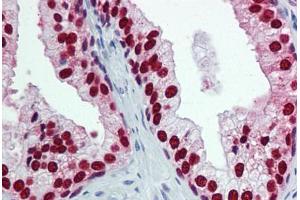 Human Prostate: Formalin-Fixed, Paraffin-Embedded (FFPE) (FOXA1 antibody  (AA 367-473))