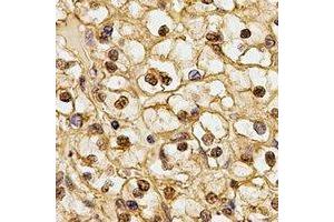 Immunohistochemical analysis of CSN1 staining in human kidney formalin fixed paraffin embedded tissue section. (GPS1 antibody)