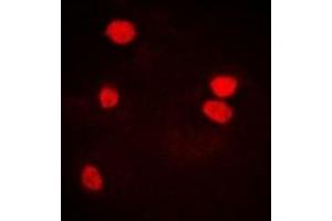 Immunofluorescent analysis of LSm4 staining in U2OS cells. (LSM4 antibody)