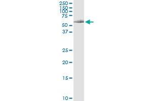 Immunoprecipitation of DNAJC7 transfected lysate using anti-DNAJC7 MaxPab rabbit polyclonal antibody and Protein A Magnetic Bead , and immunoblotted with DNAJC7 purified MaxPab mouse polyclonal antibody (B01P) . (DNAJC7 antibody  (AA 1-484))