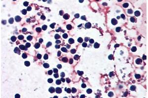 Human Peripheral Blood Leukocytes (formalin-fixed, paraffin-embedded) stained with NLRP3 antibody ABIN297366 at 2. (NLRP3 antibody  (AA 82-93))
