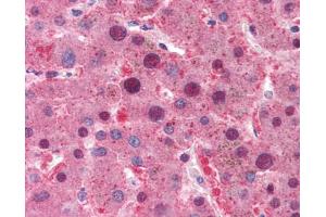 Liver: Formalin-Fixed, Paraffin-Embedded (FFPE) (Myc Tag antibody  (C-Term))