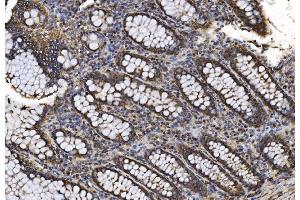 IHC analysis of Proteasome 20S Beta 7/PSMB7 using anti-Proteasome 20S Beta 7/PSMB7 antibody (ABIN7600256).