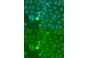 Immunofluorescence analysis of A549 cells using IRAK2 antibody. (IRAK2 antibody  (AA 1-270))