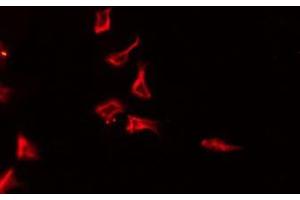ABIN6275777 staining HeLa by IF/ICC. (IL-4 antibody  (Internal Region))