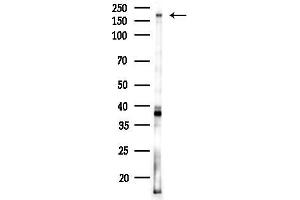 Western blot analysis of lysates from K562 cells(UV,30 min treatment), using BCL9L Antibody at 1/1000 dilution.