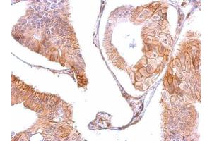 Immunohistochemistry (IHC) image for anti-Epidermal Growth Factor Receptor (EGFR) (C-Term) antibody (ABIN2854754)