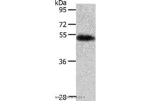 Western blot analysis of Human liver cancer tissue, using AGT Polyclonal Antibody at dilution of 1:700 (AGT antibody)