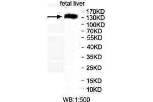 Western blot analysis of fetal liver lysates, using MEI1 antibody. (MEI1 antibody  (AA 44-237))