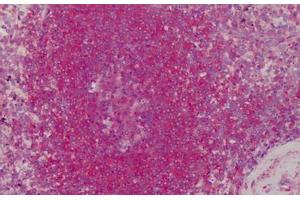 Human Spleen: Formalin-Fixed, Paraffin-Embedded (FFPE) (TM7 antibody)