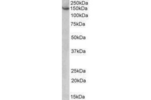 AP22427PU-N AGTPBP1 antibody staining of HeLa lysate at 1 µg/ml (35µg protein in RIPA buffer). (AGTPBP1 antibody  (Internal Region))