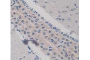 #VALUE! (KERA antibody  (AA 21-292))