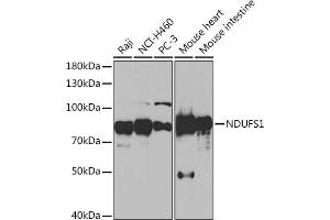Western blot analysis of extracts of various cell lines, using NDUFS1 Rabbit pAb (ABIN7268819) at 1:1000 dilution. (NDUFS1 antibody  (AA 80-290))