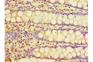 Immunohistochemistry of paraffin-embedded human colon tissue using ABIN7147675 at dilution of 1:100 (CHRFAM7A antibody  (AA 1-150))
