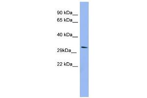 WB Suggested Anti-RRAD Antibody Titration: 0. (RRAD antibody  (Middle Region))